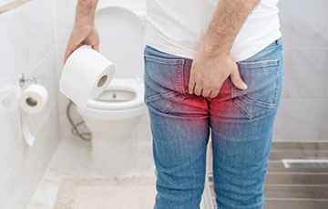 Crise hémorroïdaire : Conseils pour calmer la douleur 